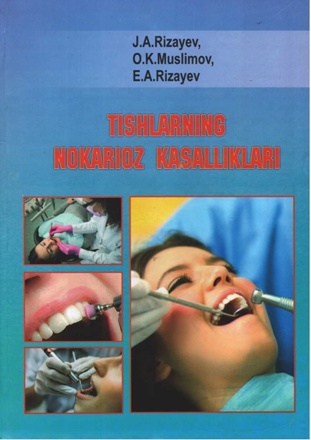 Tishlarning nokarioz kasalliklari