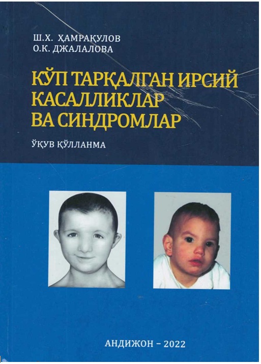 Кўп таркалган ирсий касалликлар ва синдромлар
