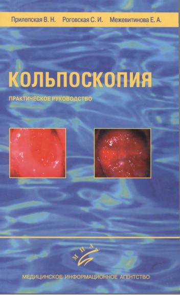 Кольпоскопия