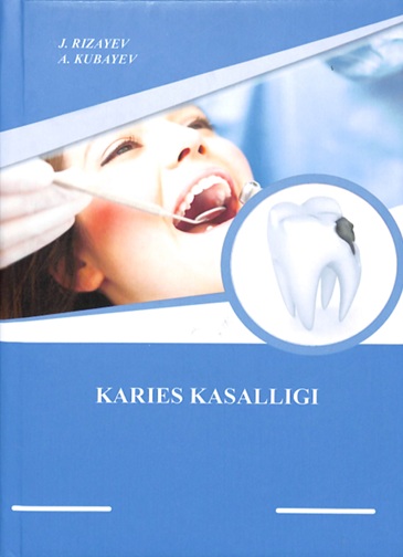 Karies kasalligi