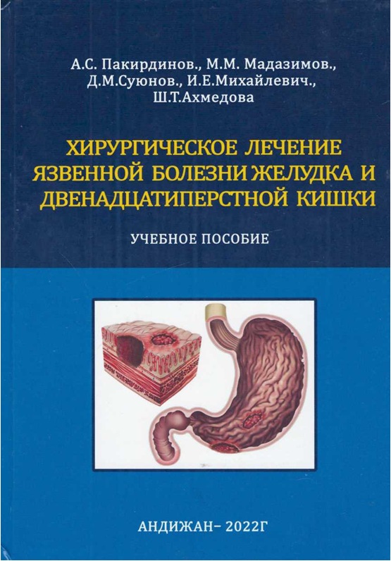Хирургическое лечение язвенной болезни желудка и двенадцатиперстной кишки