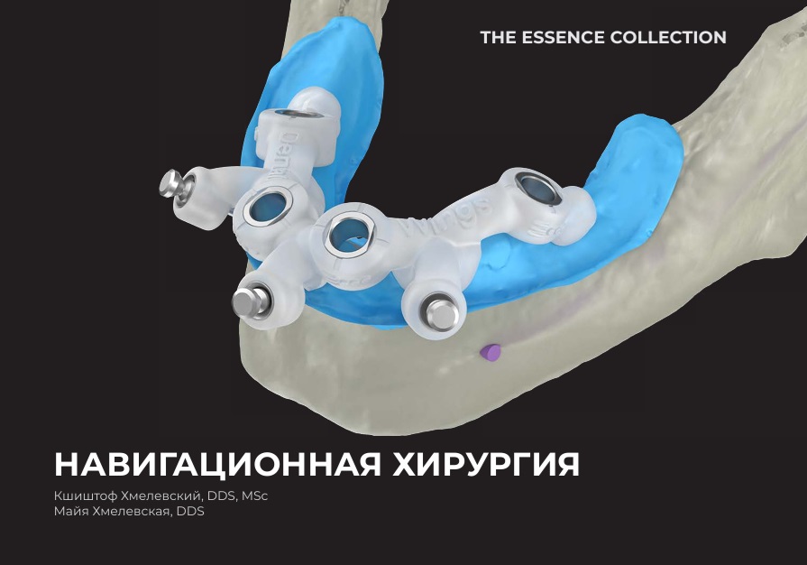 Навигационная хирургия