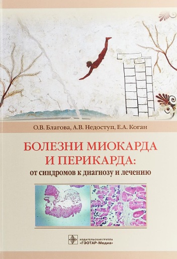 Болезни миокарда и перикарда : от синдромов к диагнозу и лечению