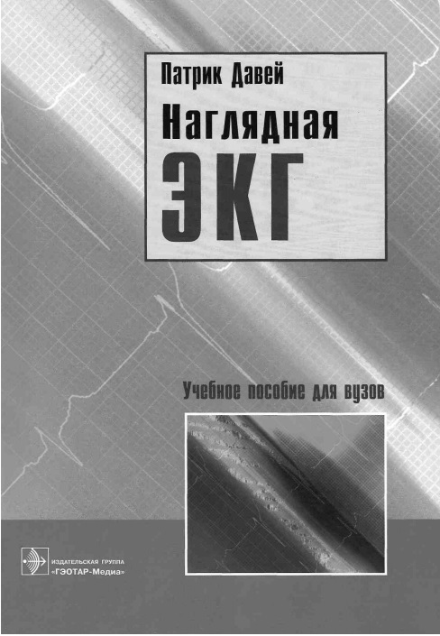 Наглядная экг
