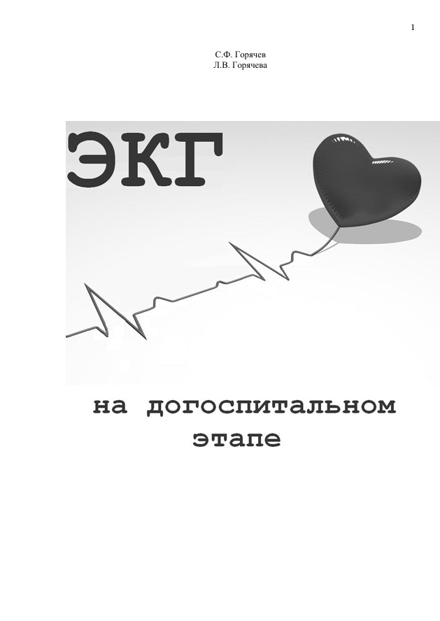 Экг на догоспитальном этапе