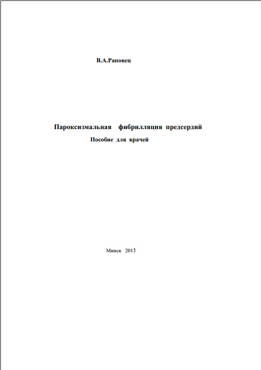 Пароксизмальная фибрилляция предсердий