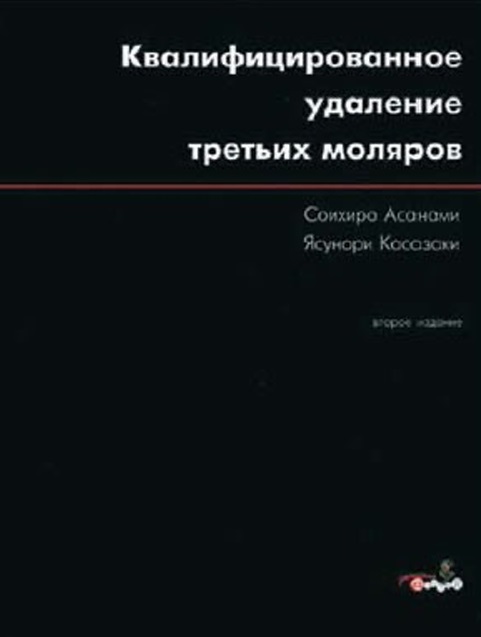 Квалифицированное удаление третьих моляров