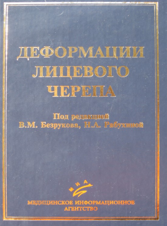 Деформации лицевого черепа