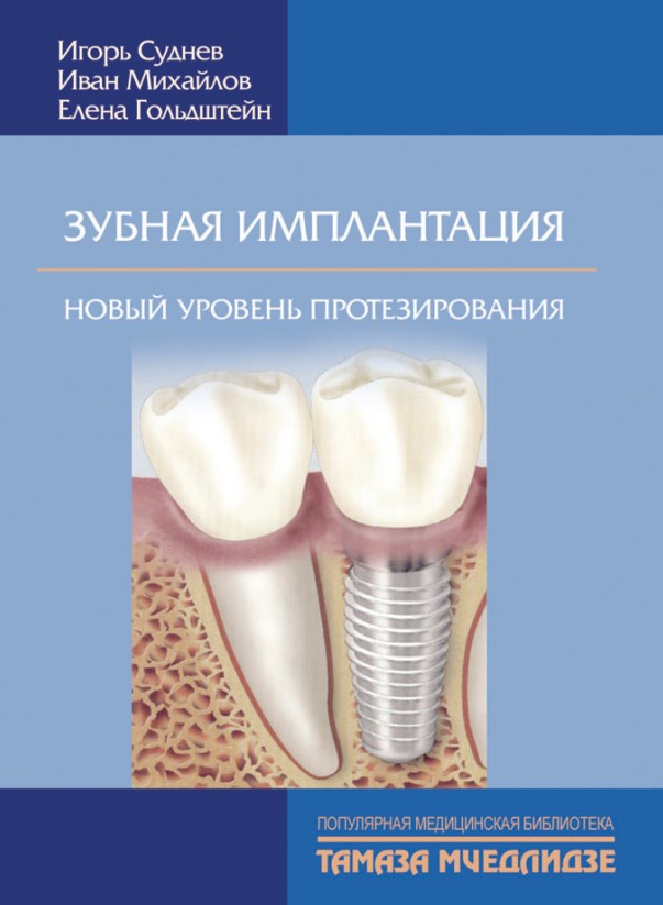 Зубная имплантация