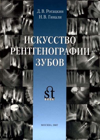 Искусство рентгенографии зубов