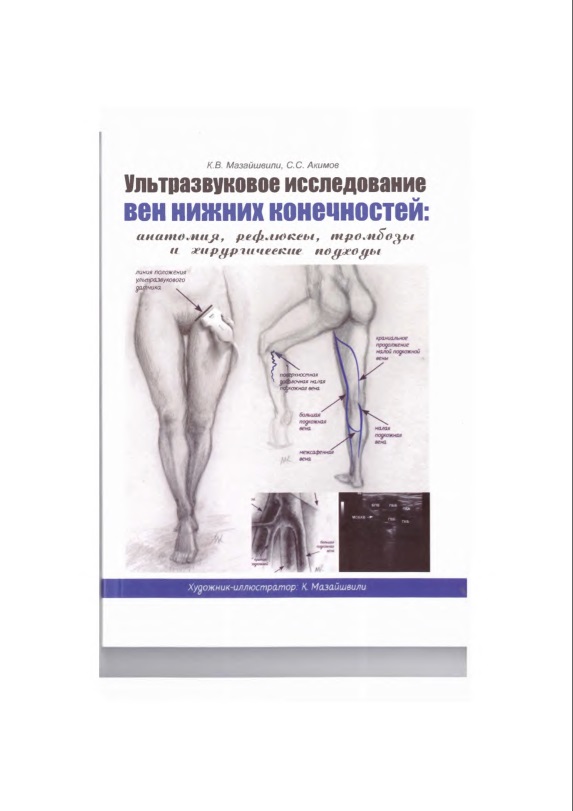 Ультразвуковое исследование