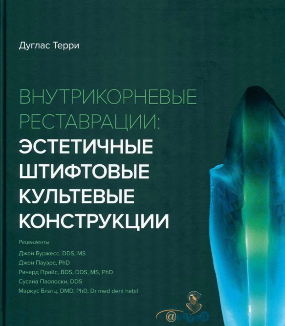 Внутрикорневые реставрации: эстетичные штифтовые культевые конструкции