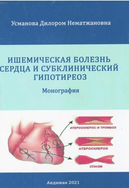 Ишемическая болезнь сердца и субклинический гипотериоз