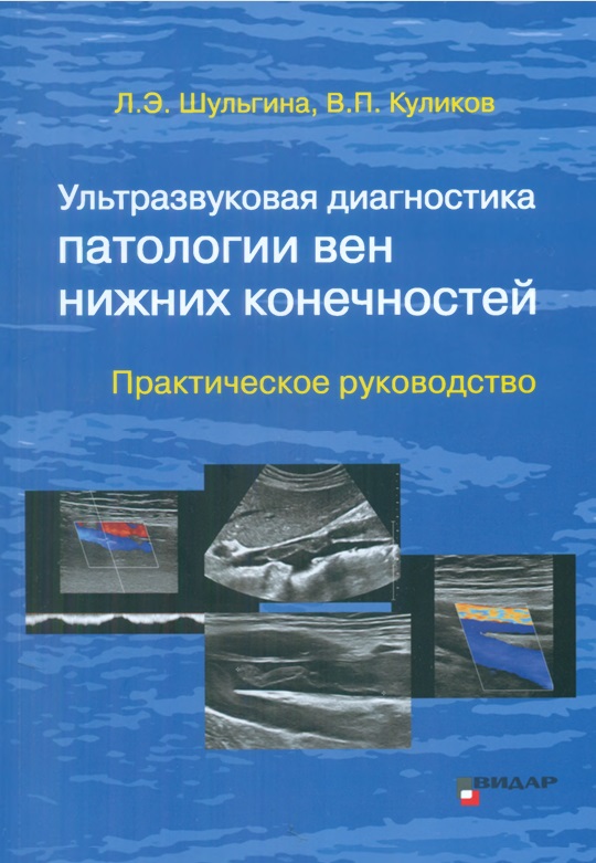 Ультразвуковая диагностика патологии вен нижних конечностей
