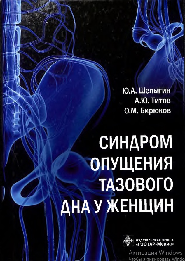 Синдром опущения тазового дна у женщин