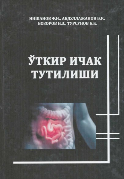 Ўткир ичак тутилиши