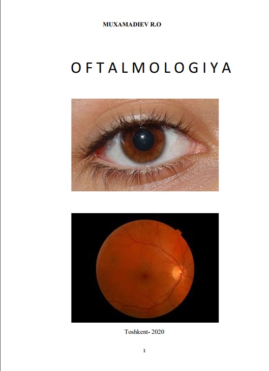 Oftalmologiya