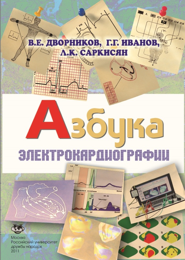 Азбука Электрокардиографии