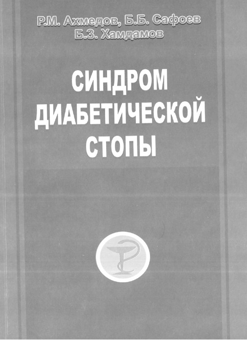 Синдром диабетической стопы