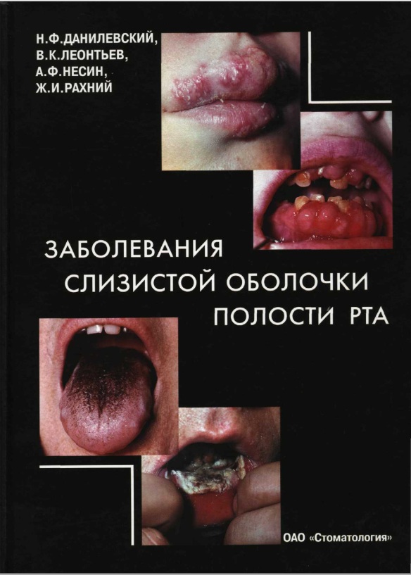 Заболевания слизистой оболочки полости РТА