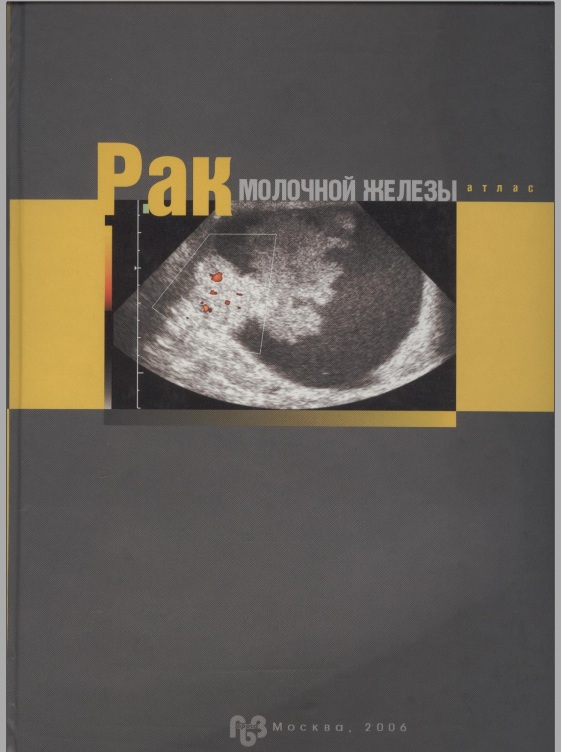 Рак молочной железы
