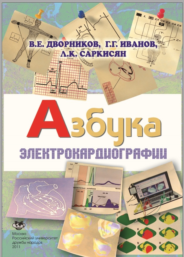 Азбука электрокардиографии
