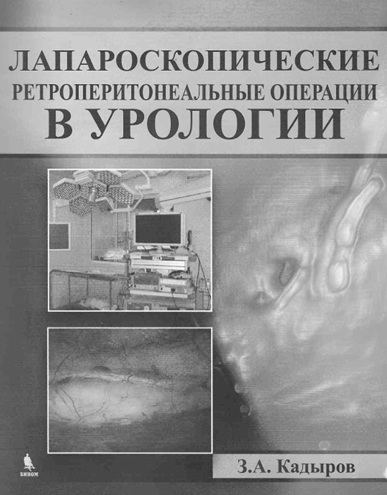 Лапороскопические репроперитонеальные операции в урологии
