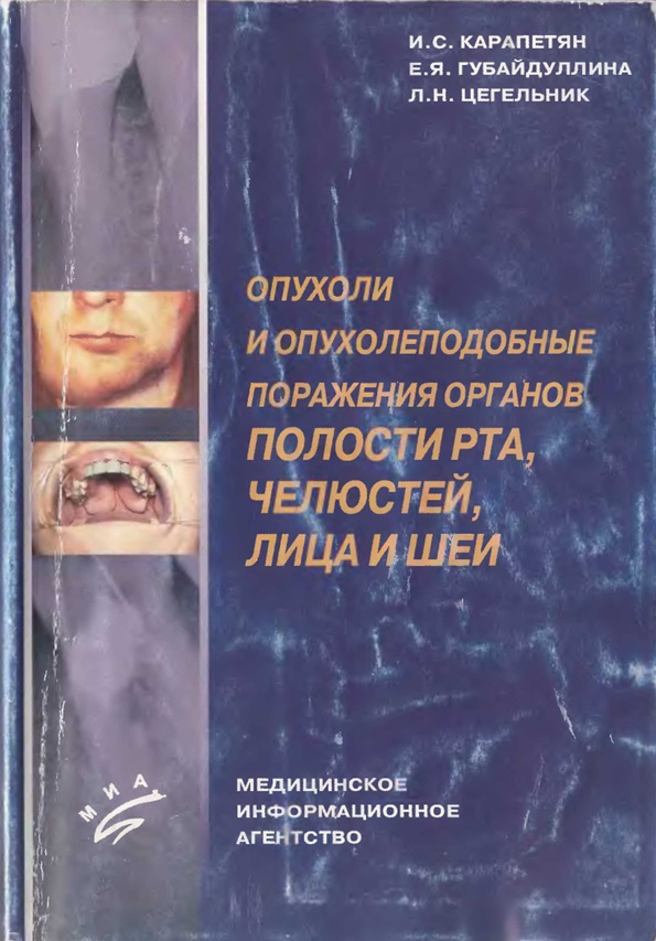 Опухоли и опухолеподобные поражения органов полости рта, челюстей, лица и шеи