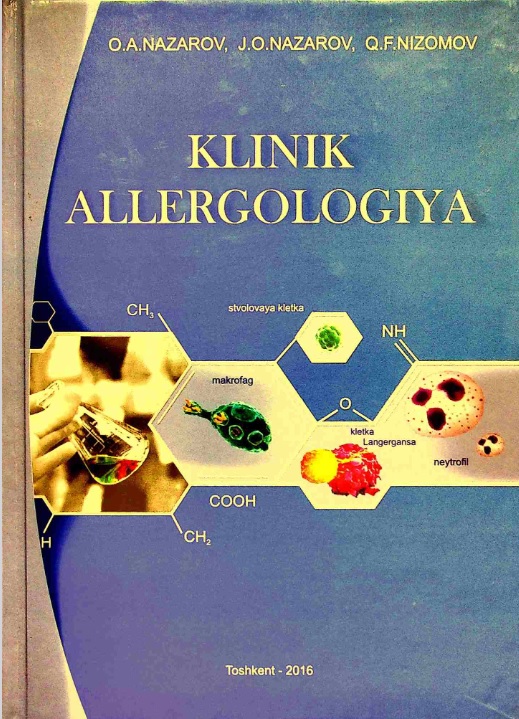 Klinik allergologiya