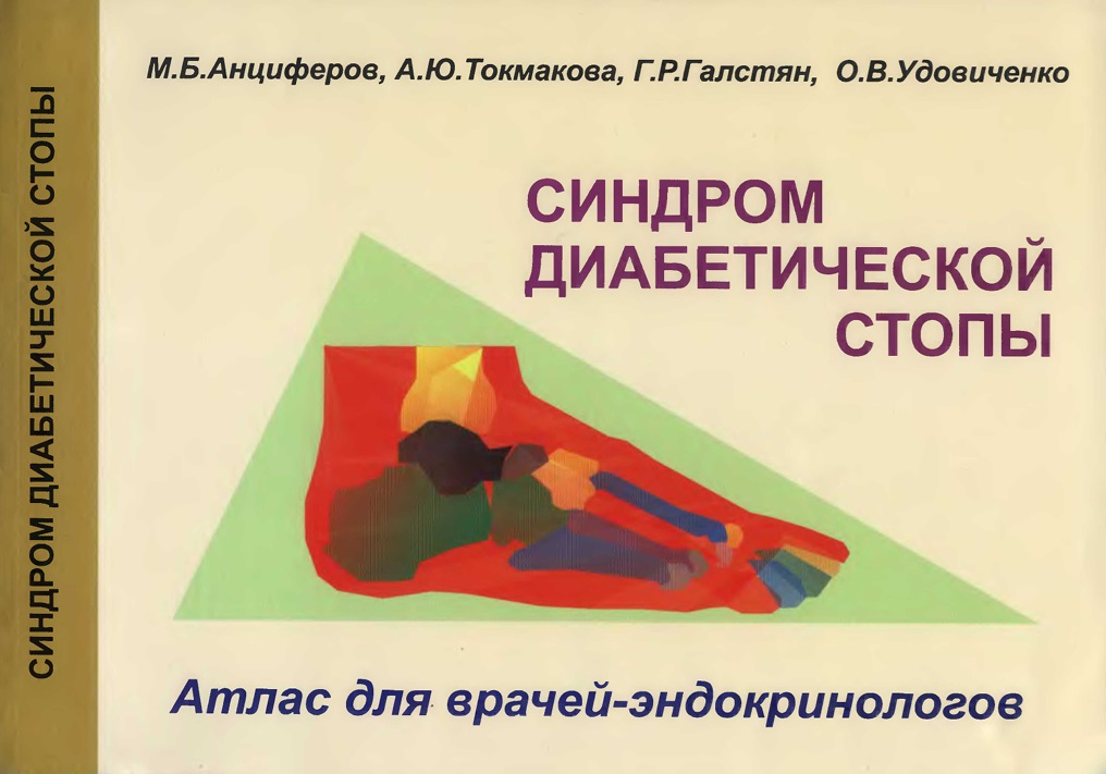 Синдром диабетической стопы: Атлас для врачей-эндокринологов