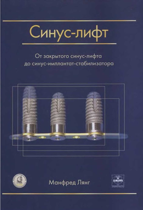 Синус-лифт. От закрытого синус-лифта до синус-имплантат-стабилизатора
