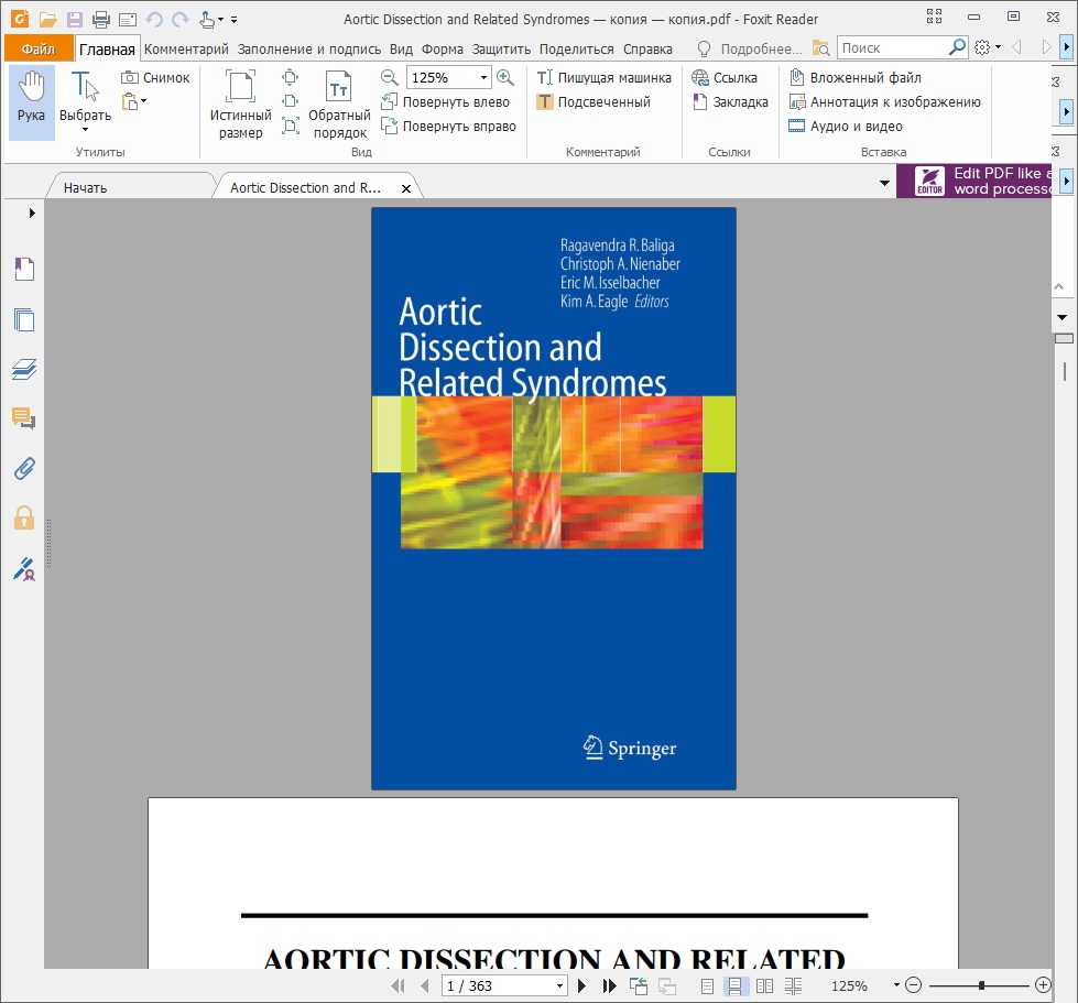 Aortic dissection and related syndromes