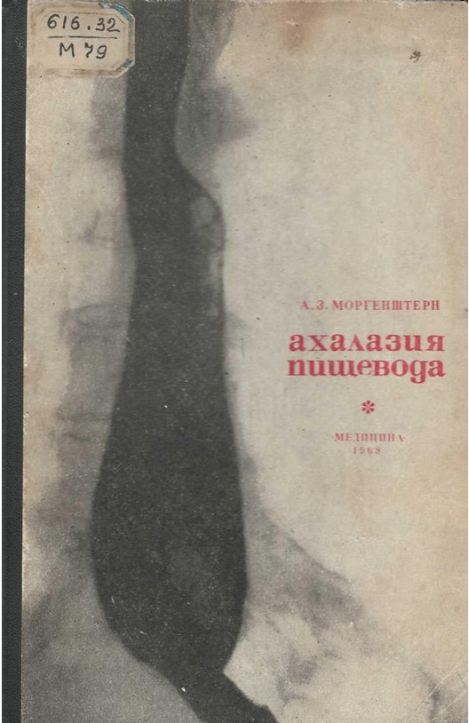Ахалазия пищевода