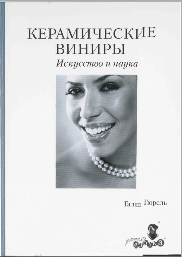 Керамические виниры