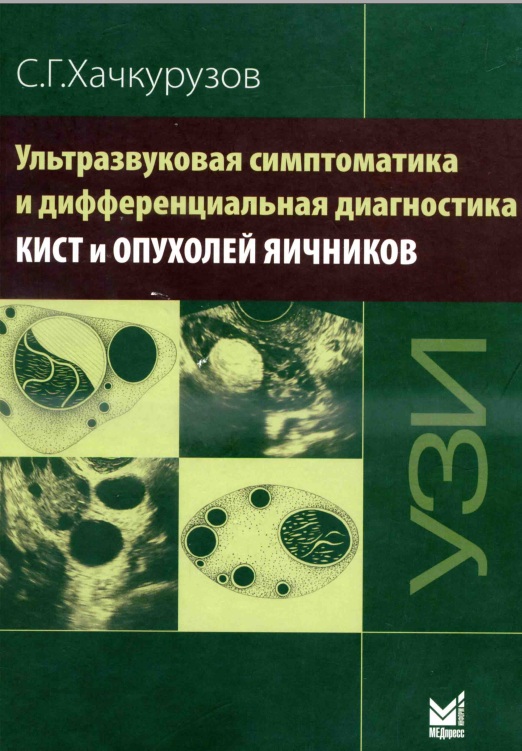 Ультразвукова симптоматика и дифференциальная диагностика кист и опухолей яичников