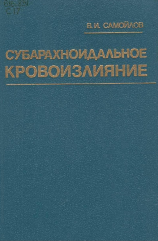 Субарахноидальное кровоизлияние