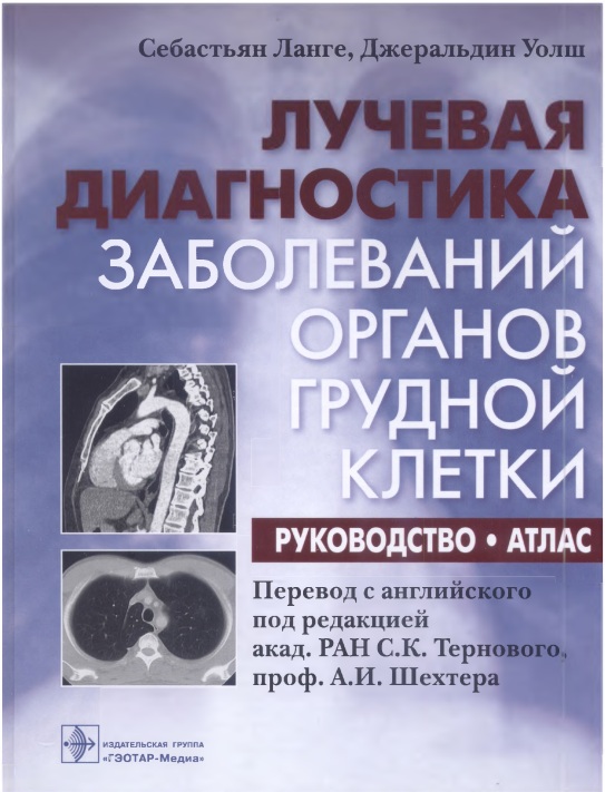 Лучевая диагностика заболеваний органов грудной клетки