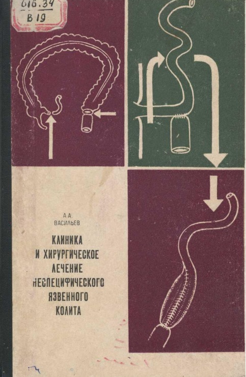 Клиника и хирургическое лечение неспецифического язвенного колита