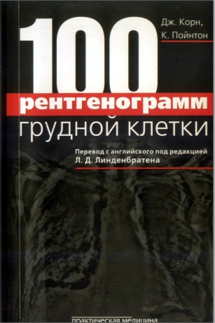 100 рентгенограмм грудной клетки