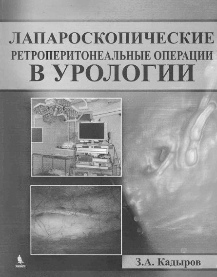 Лапароскопические ретроперитонеальные операции в урологии