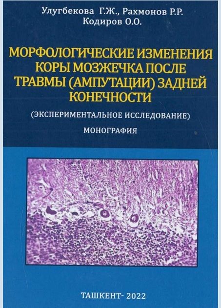 Морфологические изменения коры мозжечка после травмы (ампутации) задней конечности