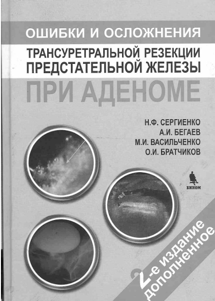 Ошибки и осложения трансуретральной резекции предстательной железы при аденоме