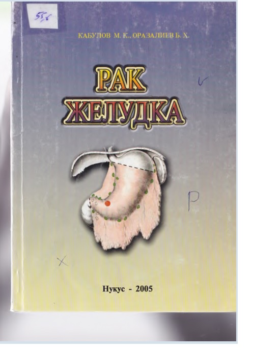 Рак желудка