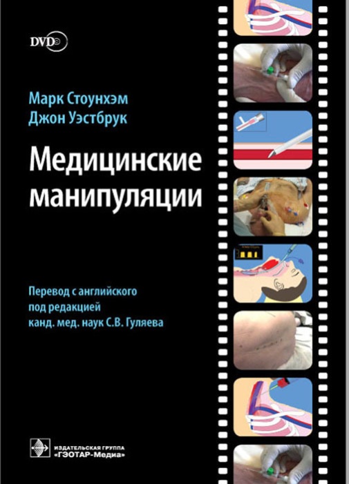 Медицинская манипуляции