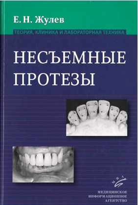 Несъемные протезы