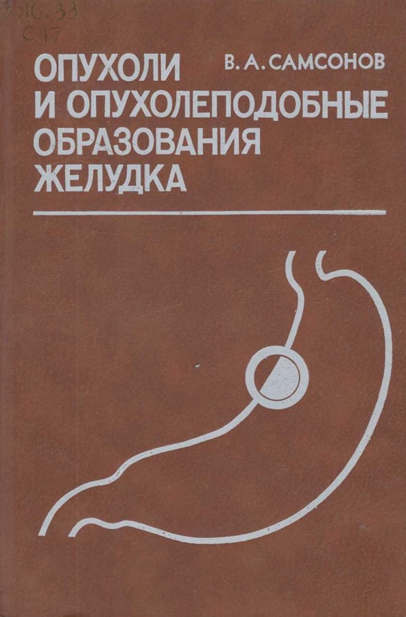 Опухоли и опухолеподобные образования желудка
