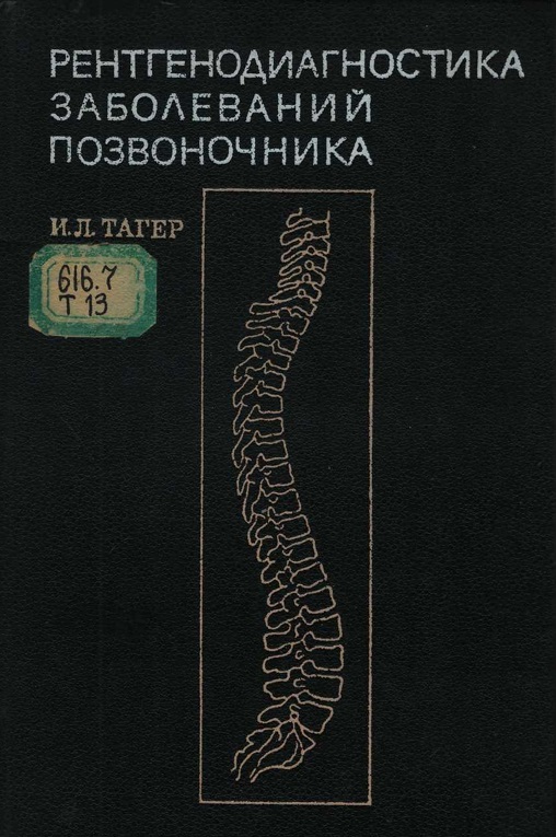 Рентгенодиагностика заболеваний позвоночника