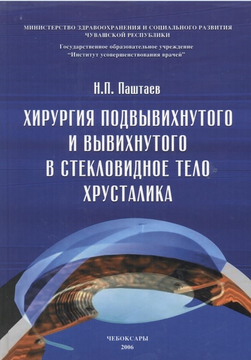 Хирургия подвывихнутого и вывихнутого в стекловидное тело хрусталика