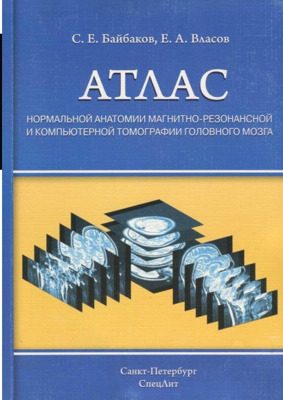 АТЛАС нормальной анатомии магнитно-резонасной и комппьютерной томографии головного мозга