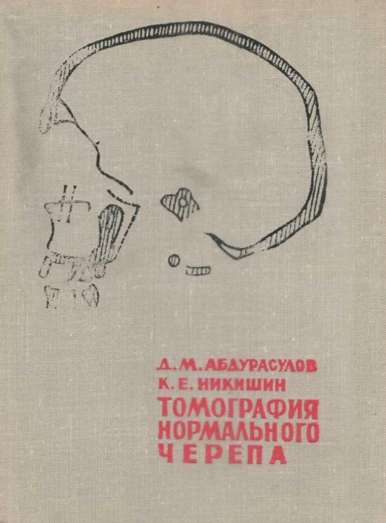 Томография нормального черепа